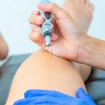 fisioterapia postquirúrgica rodilla en Alicante